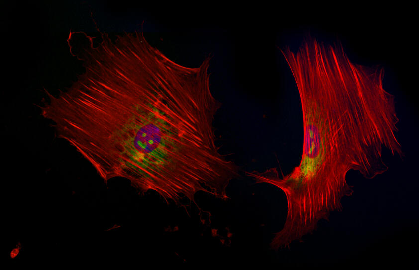 Foreign exosomes in green baing uptaked by another cell in red