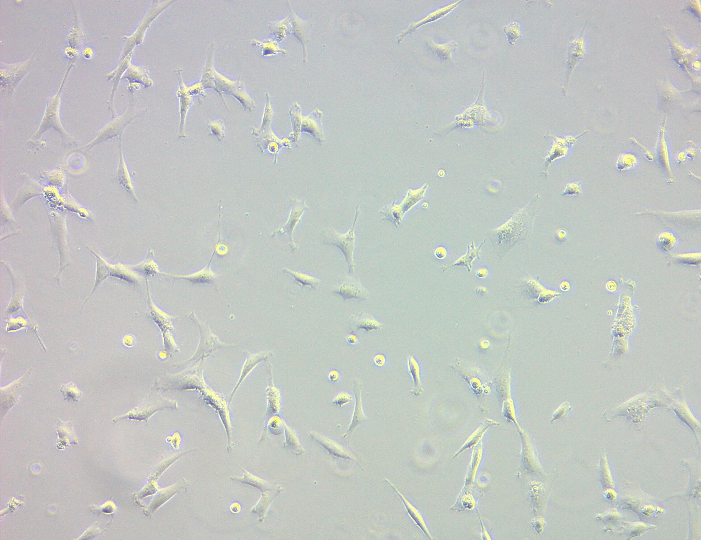 Mesenchymal Stem Cells in culture